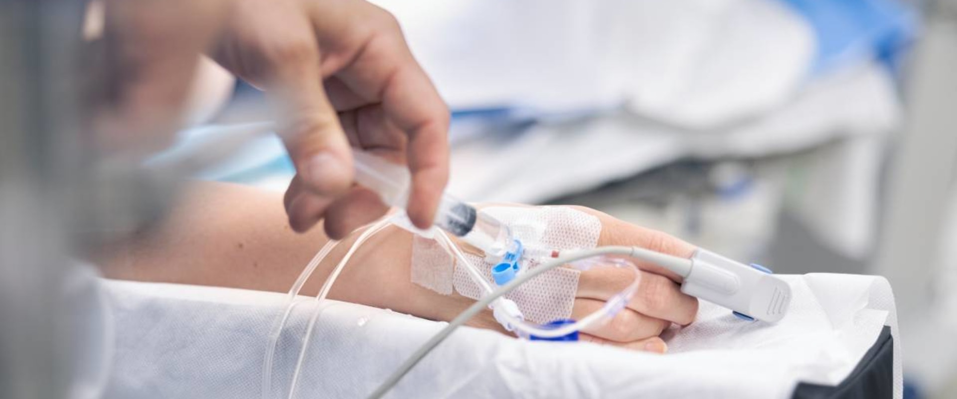 Understanding IV Sedation: Medication Delivery through an IV Line in the Arm or Hand